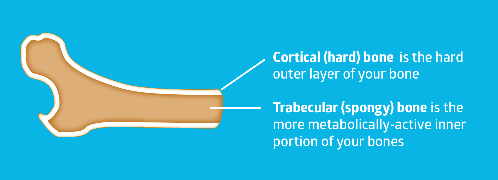 Trabecular bone vs. cortical bone