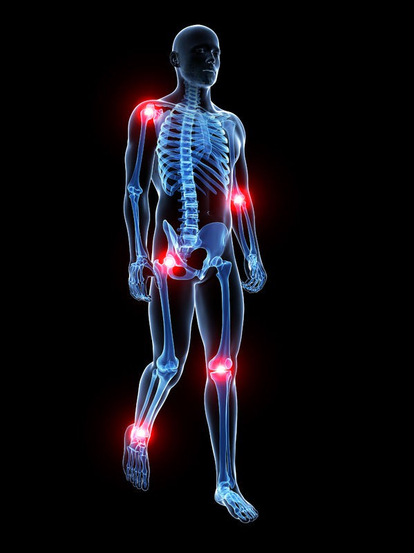 Osteoporosis in Men - Where Do They Get It?