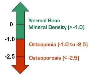 What are the effects of a bone marrow density scan?