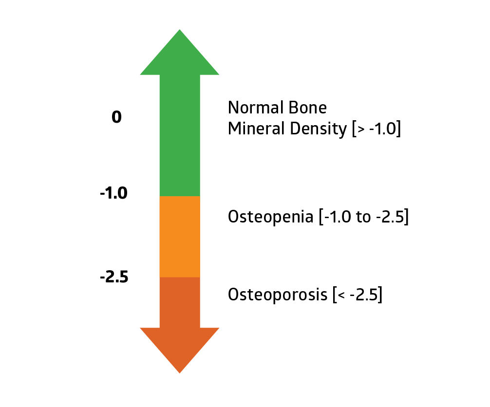 Bone Density Chart: A Visual Reference of Charts | Chart Master