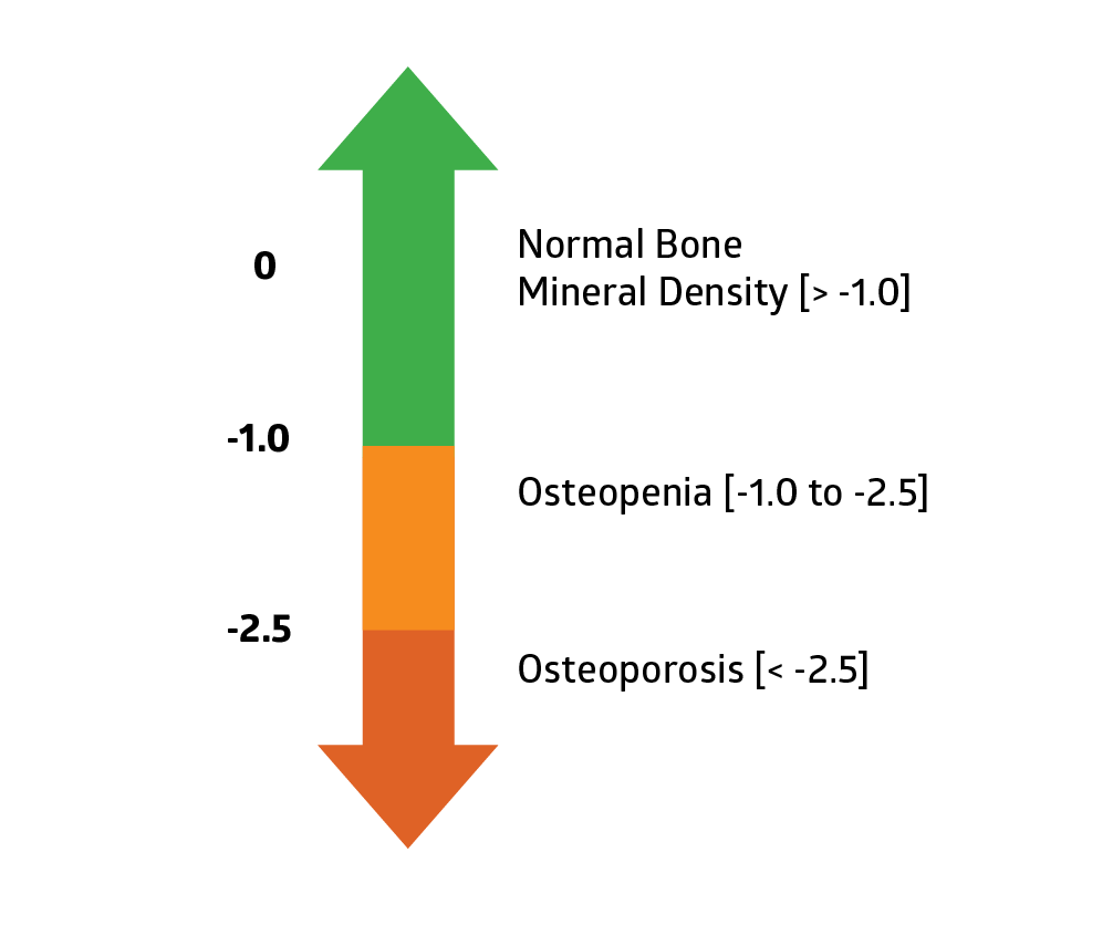 Dexa Scan Score Chart