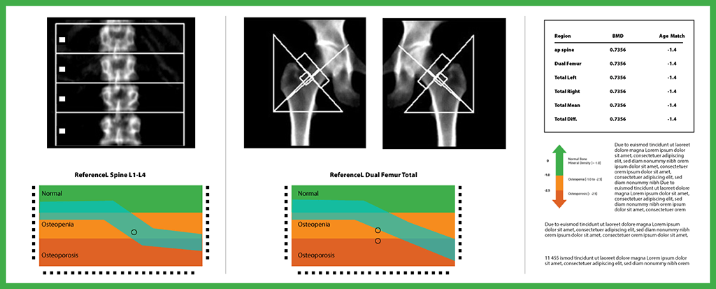 DEXA Scan Everything You Need Want To Know