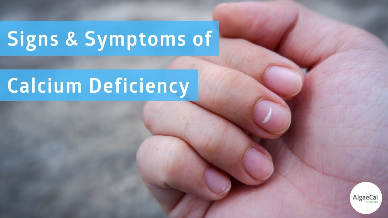 Calcium Deficiency 17 Signs & Symptoms To Watch Out For